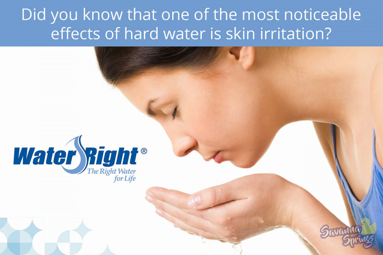 Hard Water and Skin Irritation Savanna Springs Water Solutions